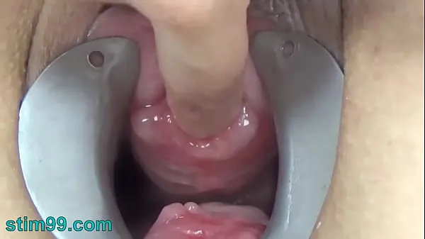 HD Female Endoscope Camera in Pee Hole with Semen and Sounding with Dildo συνολικός σωλήνας